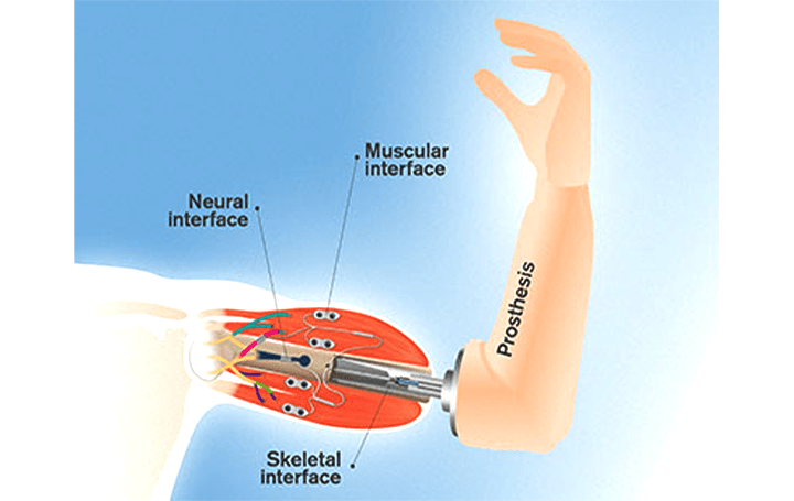 脳に伝達して本当の手のように触覚を感じる スウェーデンのチャルマース工科大学が開発する 神経筋骨格義肢 Webマガジン Axis デザインのwebメディア